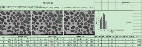 电镜统计分析