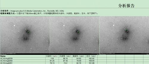 电镜测量分析