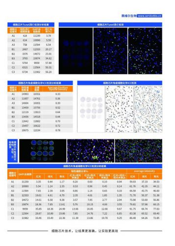 组化/荧光分析（细胞芯片数字扫描）