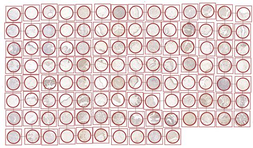 组化分析（组织芯片数字扫描）
