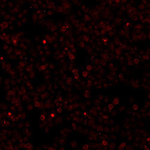 激光共聚焦活细胞成像