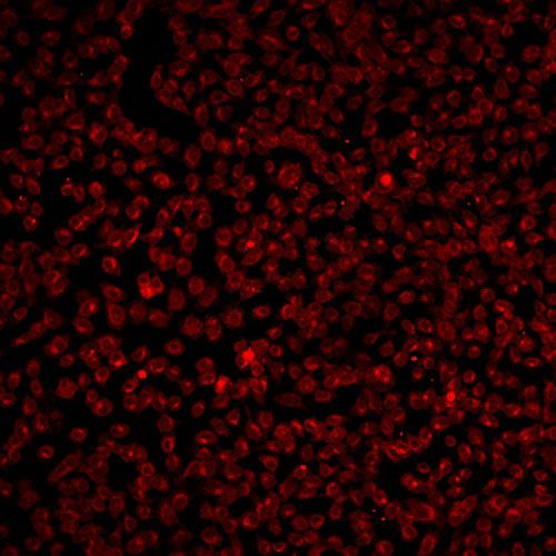 激光共聚焦活细胞成像