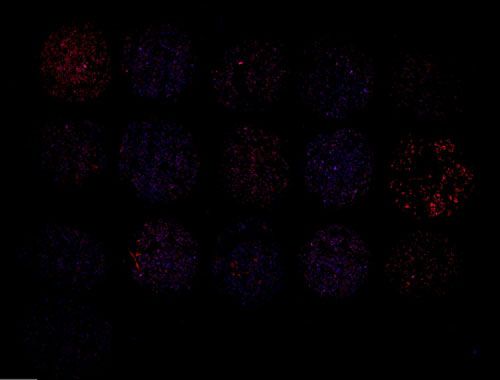 免疫荧光（单标，细胞芯片）