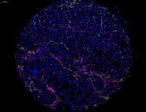 组织芯片扫描(荧光三标 四色)