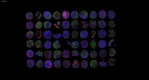 组织芯片扫描(荧光三标 四色)