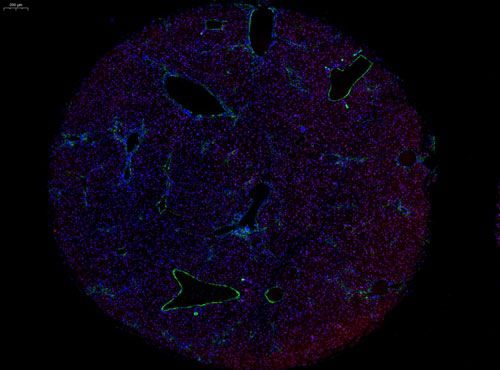 组织芯片扫描(荧光双标 三色)