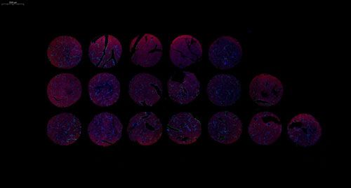 组织芯片扫描(荧光双标 三色)