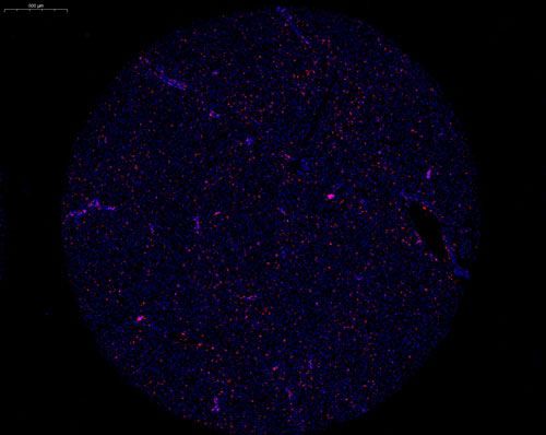 组织芯片扫描(荧光单标 双色)