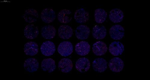 组织芯片扫描(荧光单标 双色)