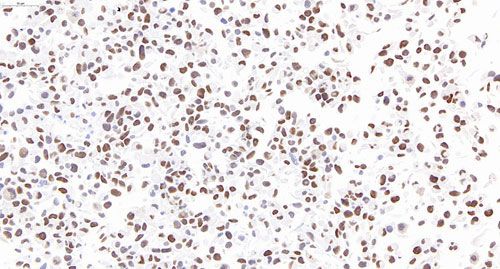 细胞芯片ICC检测+扫描分析