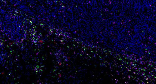 普通切片扫描(荧光四标 五色)