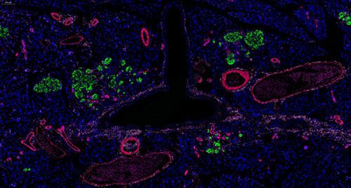 普通切片扫描(荧光四标 五色)