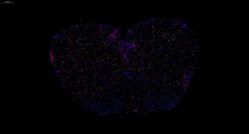 普通切片扫描(荧光双标 三色)