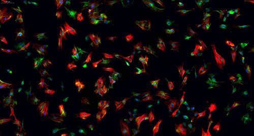 普通切片扫描(荧光双标 三色)