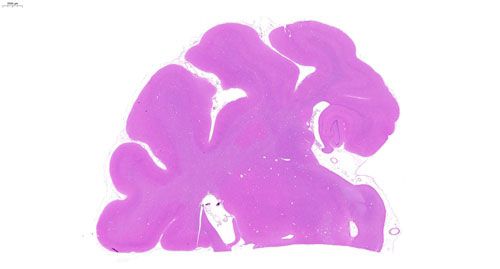 双宽玻片扫描（白光）