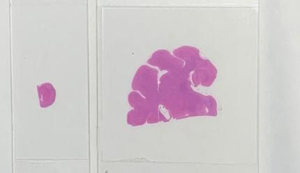 双宽玻片扫描（白光）