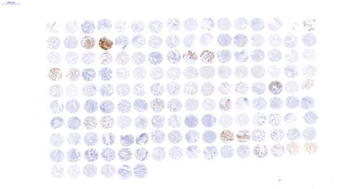 组织芯片扫描(白光)