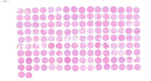 组织芯片扫描(白光)