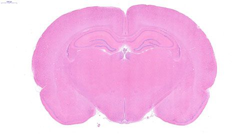 普通切片扫描（白光）