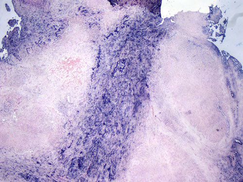 原位杂交（BCIP/NBT）