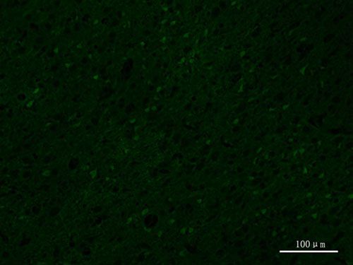 FJB荧光染色