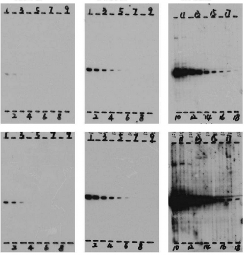 Western Blot