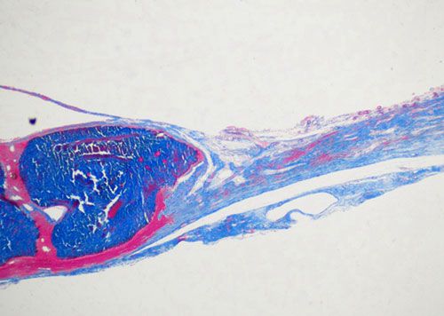 未脱钙骨Masson染色